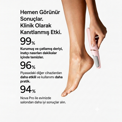Nova Pro Şarjlı Ayak Törpüsü